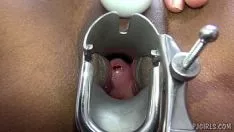 Riproduci Onanismo ginecologico
